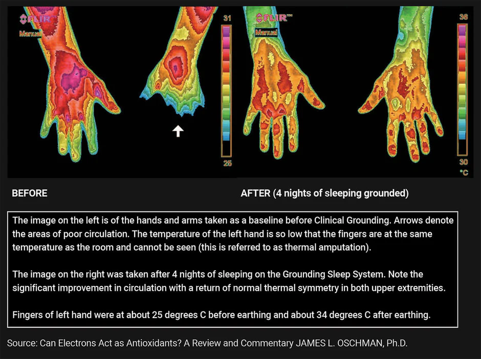 Thermal imaging comparison showing inflammation reduction in the body after grounding.